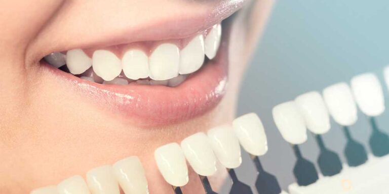 cosmetic-dentistry
